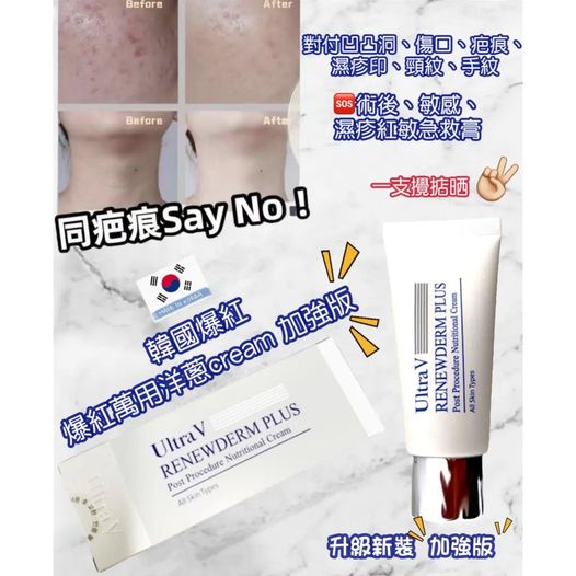 供應商現貨💫韓國🇰🇷 Ultra V DDK 再生修復膏 50ml【洋蔥Cream 】正貨標籤 | 落單後約3-5個工作天寄出 娉婷貿易公司 Exquisite Beauty Trading Company