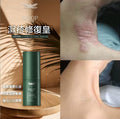 🌸MSOP濕疹修復皇 | 預訂約1-2星期 娉婷貿易公司 Exquisite Beauty Trading Company