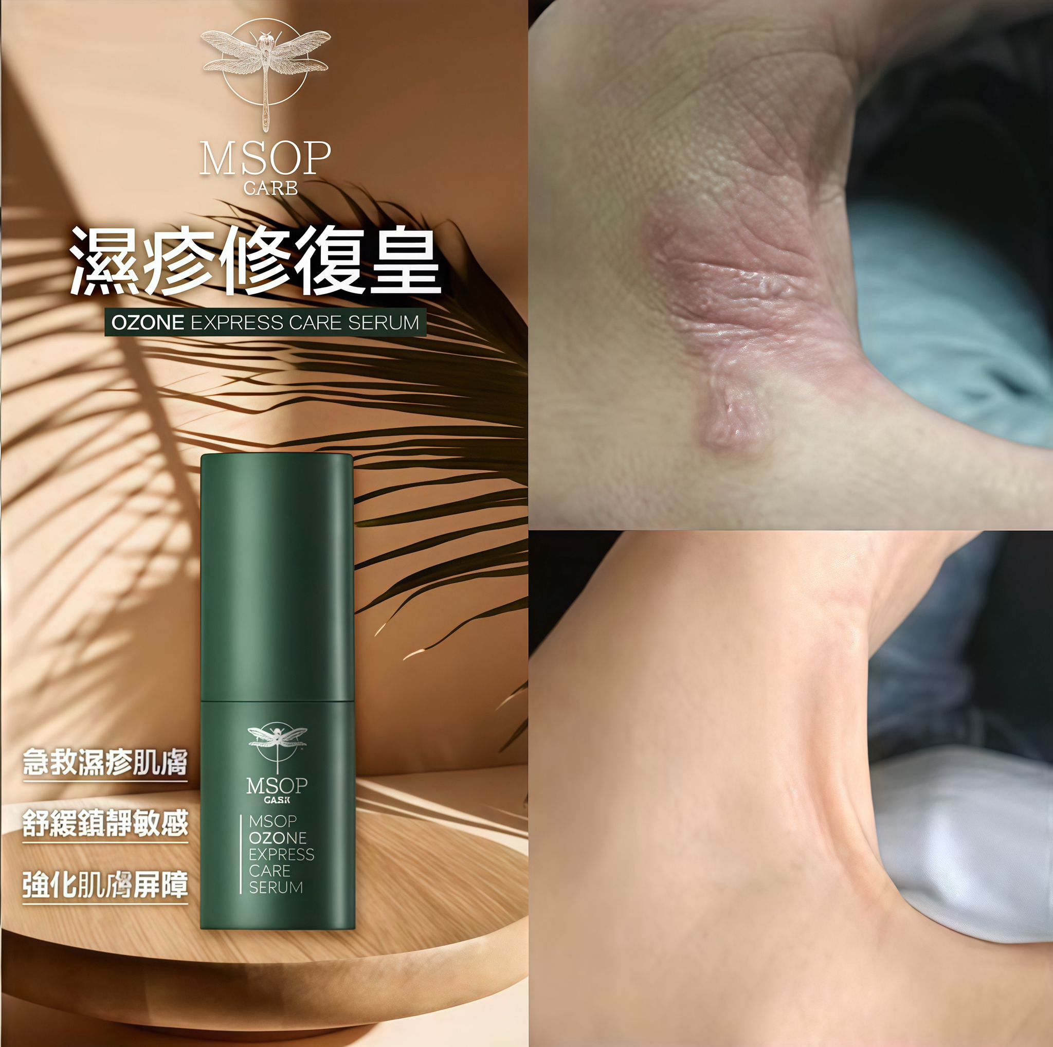 🌸MSOP濕疹修復皇 | 預訂約1-2星期