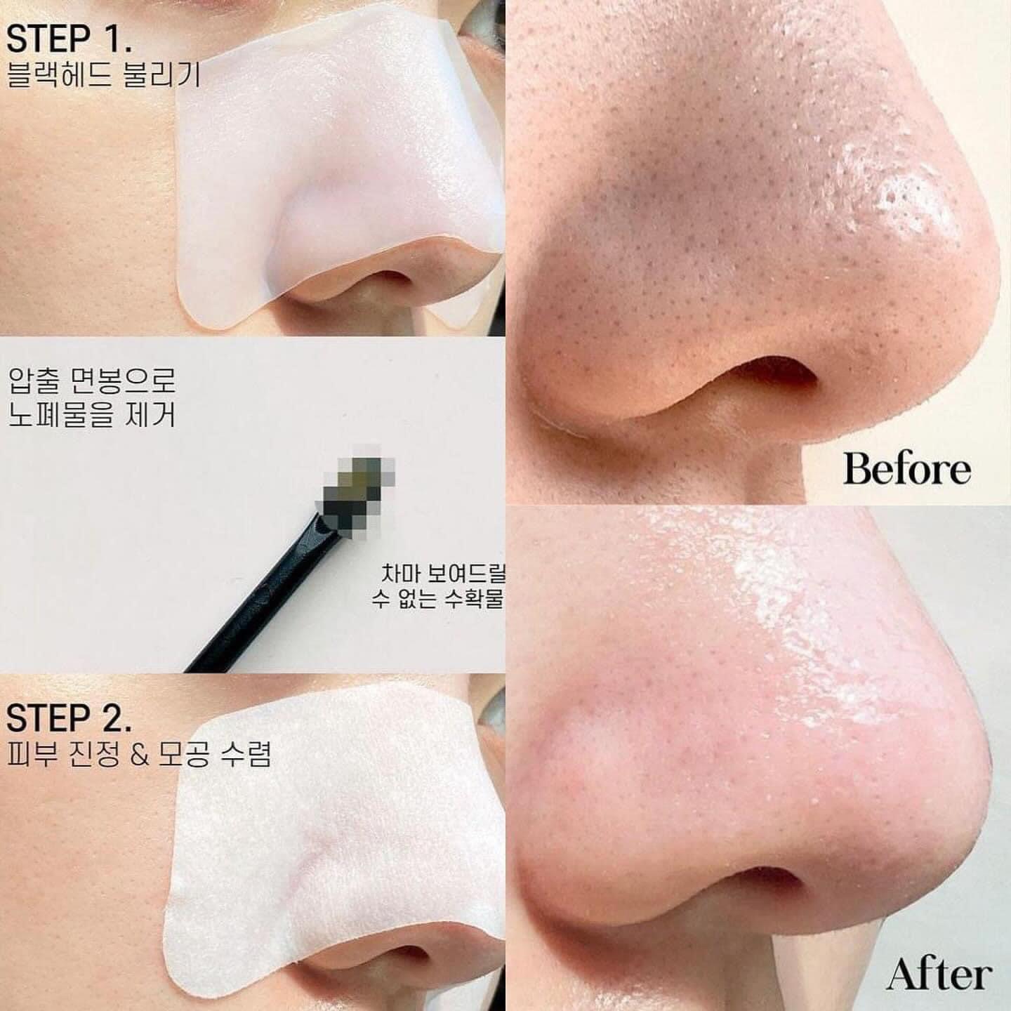 現貨🌸🇰🇷ilso溫和深層清潔黑頭鼻貼 | 落單後約3-5個工作天寄出