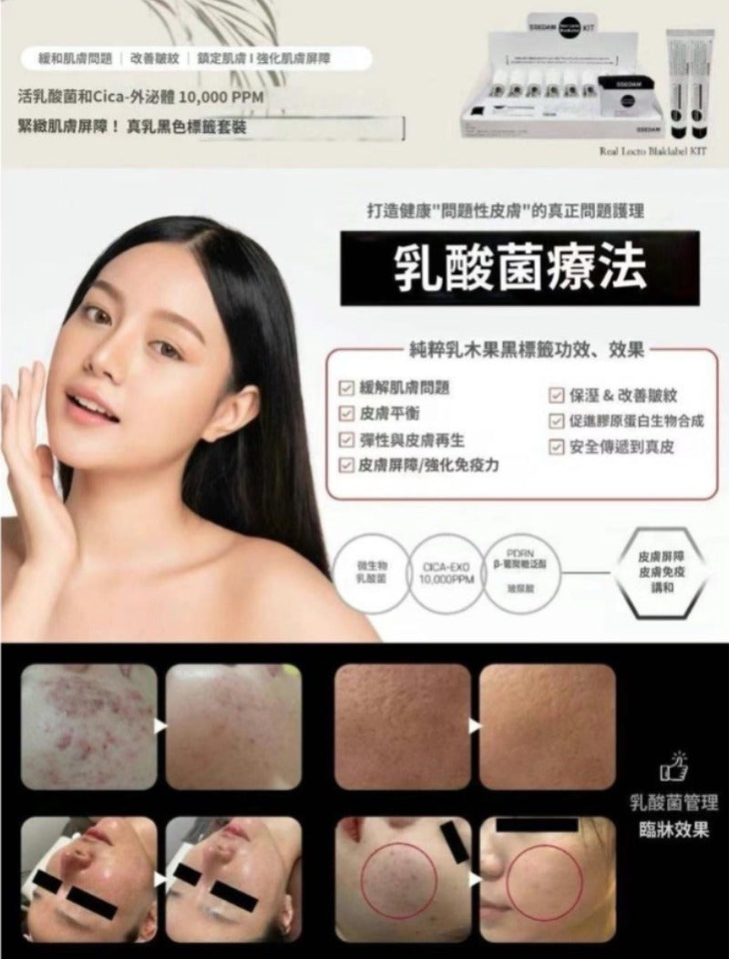 現貨🌸超多客買!! 韓國🇰🇷頂級醫美品牌 SSEDAM 乳酸菌積雪草外泌體療程套裝 1盒8次 | 落單後約3-5個工作天寄出