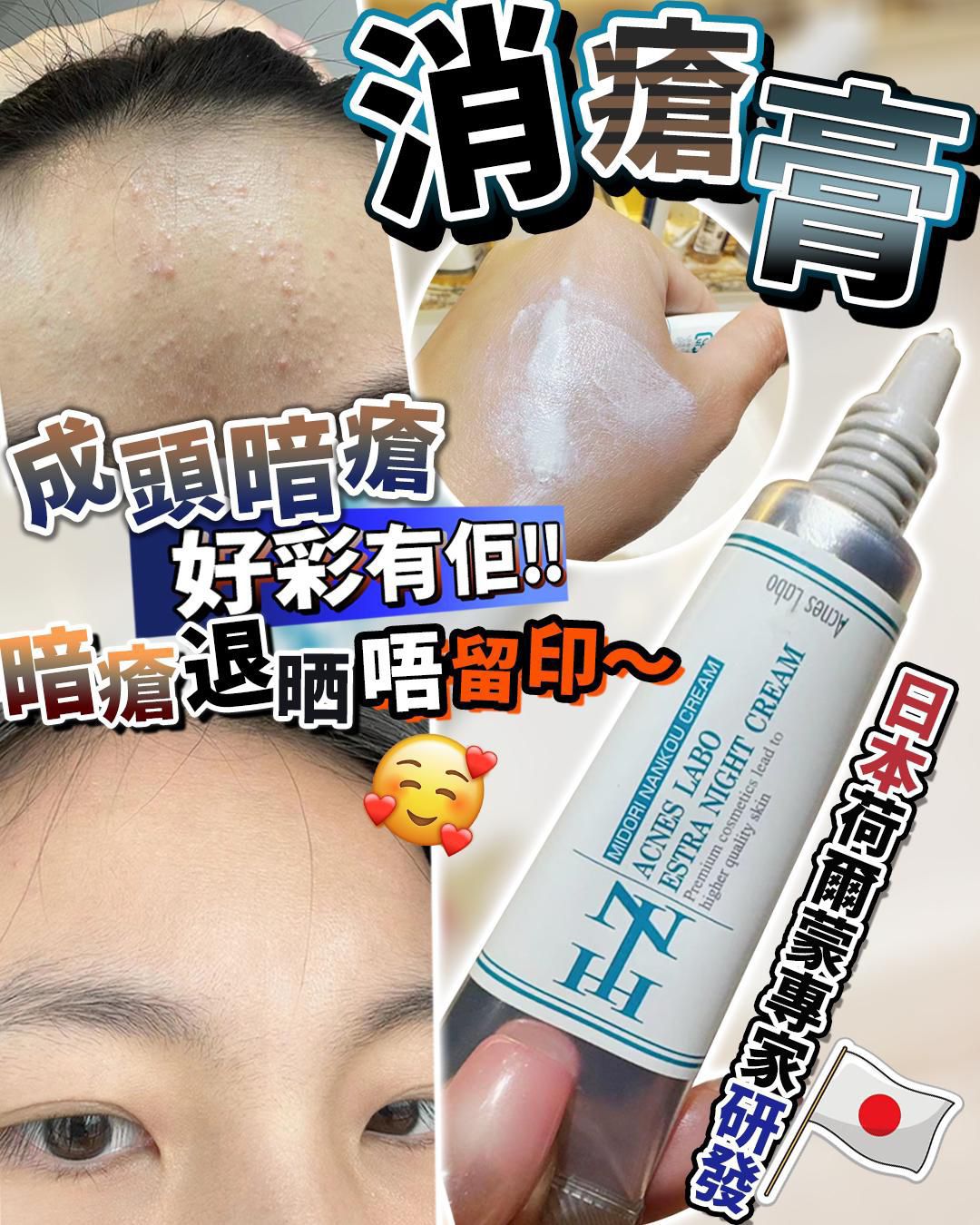 🌸消瘡膏 送 15張貼 | 預訂約1星期 娉婷貿易公司 Exquisite Beauty Trading Company