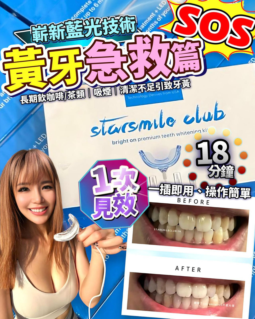 🌸StarSmileClub USA🇺🇸 Blue Light Teeth Whitening Device | Pre-order approx. 2-3 weeks