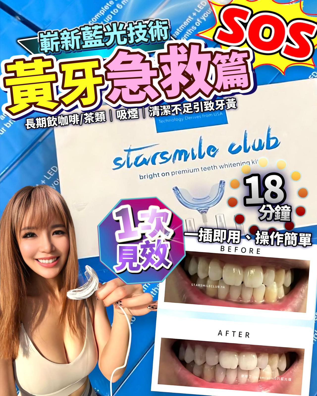 🌸StarSmileClub美國🇺🇸藍光美白牙齒機 | 預訂約1-2星期