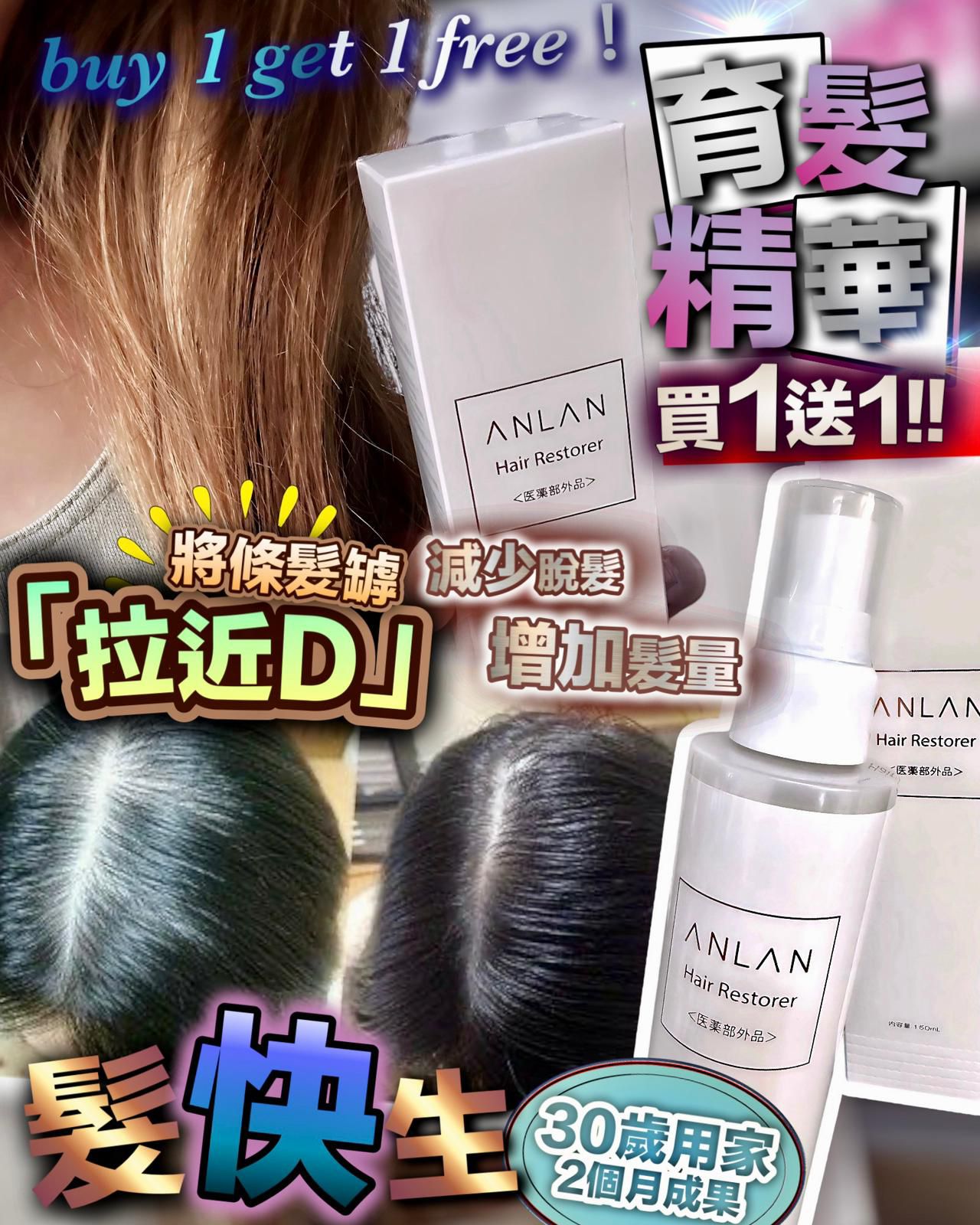 🌸Anlan 髮快生 育髮精華 150ml‼️買1送1‼️ | 預訂約1-2星期 娉婷貿易公司 Exquisite Beauty Trading Company