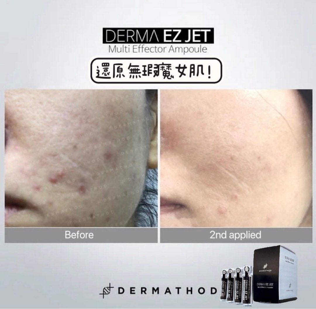 供應商現貨🌸DERMA EZ JET 魔女印精華療程套裝 Multi Effector Ampoule Treatment SET 一套4支精華+8片面膜 | 落單後約3-5個工作天寄出