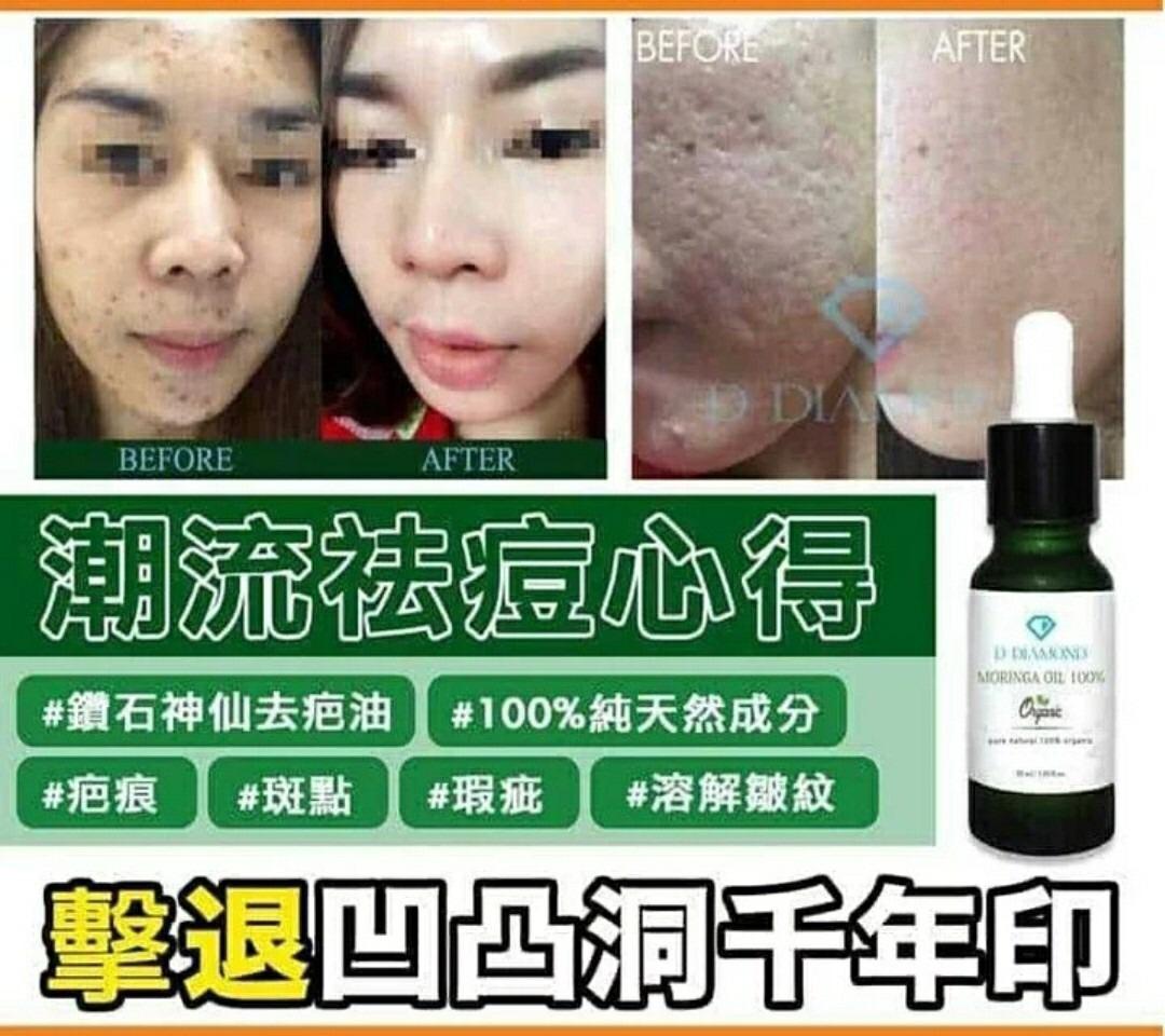 7/11截🌸泰國直送🇹🇭 D Diamond 鑽石神仙去疤油 (10ml) (100% Moringa Oil) | 預訂約12月初至中