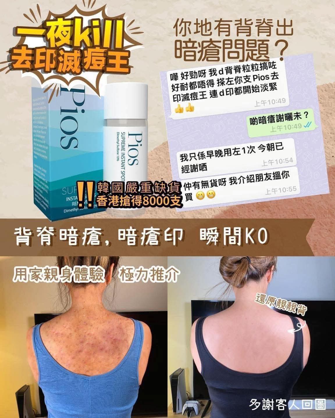 現貨🌸Pios 一夜KILL 去印滅痘王 🔥🔥 | 落單後約3-5個工作天寄出