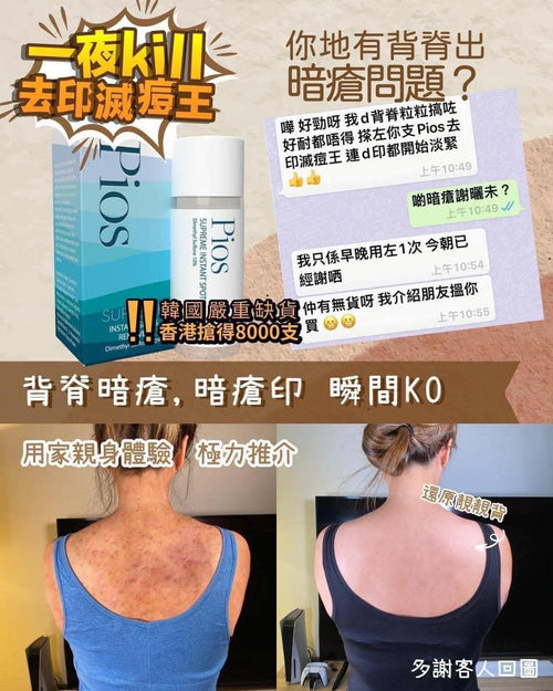 【24小時網站自助下單】現貨🌸Pios瞬時去痘淨膚精華 | 落單後約3-5個工作天寄出 娉婷貿易公司 Exquisite Beauty Trading Company