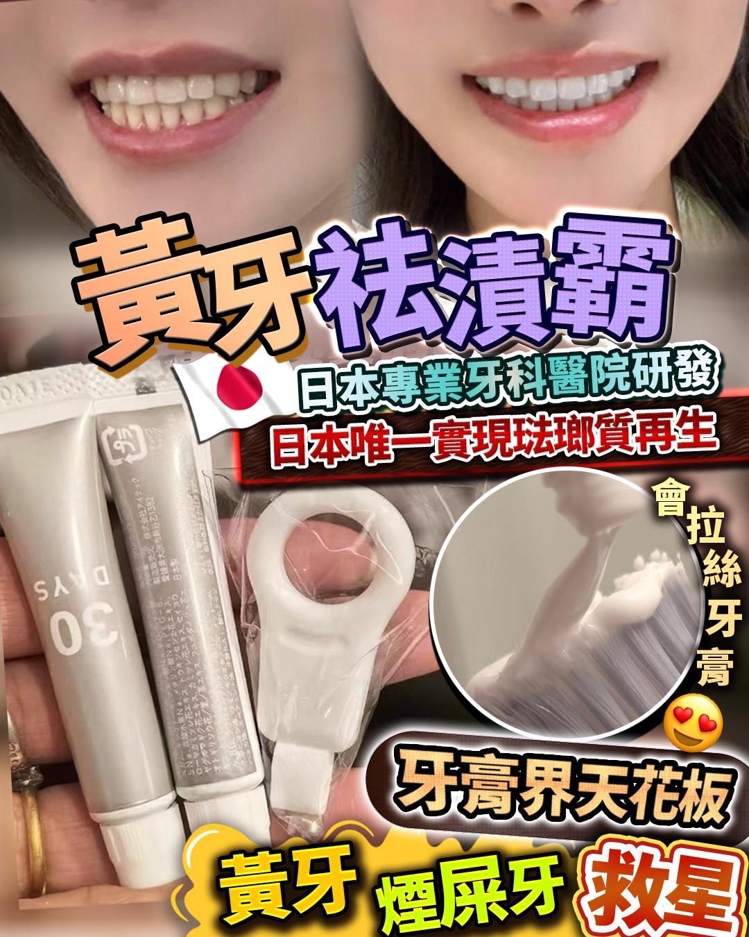現貨🌸黃牙祛漬霸 | 落單後約3-5個工作天寄出