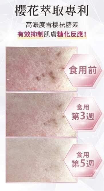 30/5截🌸台灣 日南製藥新姬白錠(一盒30粒) | 預訂約6月尾至7月初