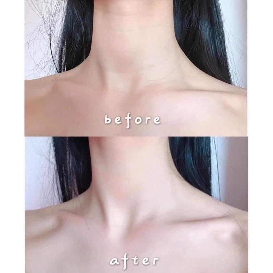 現貨🌸韓國🇰🇷VELLA 深層撫紋熨斗頸膜(5gx5片)一盒 | 落單後約3-5個工作天寄出