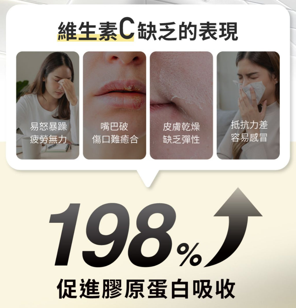 現貨🌸RELOVE 西印度櫻桃維他命C超能膠囊 1包30粒 | 落單後約3-5個工作天寄出