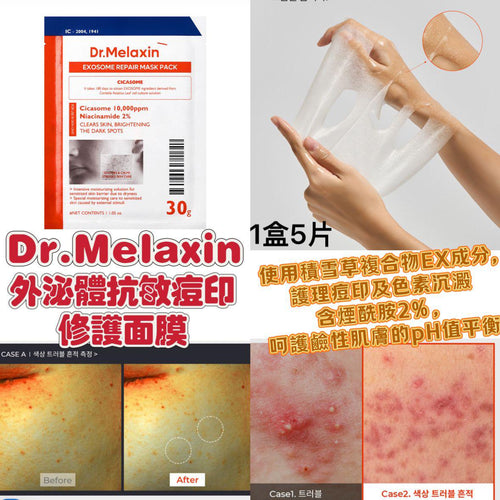 現貨🌸Dr.Melaxin 外泌體抗敏痘印修護面膜 5片 | 落單後約3-5個工作天寄出 娉婷貿易公司 Exquisite Beauty Trading Company
