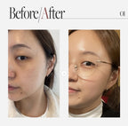 現貨🌸AUIO 膠原蛋白微針精華 300 | 落單後約3-5個工作天寄出