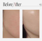 現貨🌸AUIO 膠原蛋白微針精華 300 | 落單後約3-5個工作天寄出