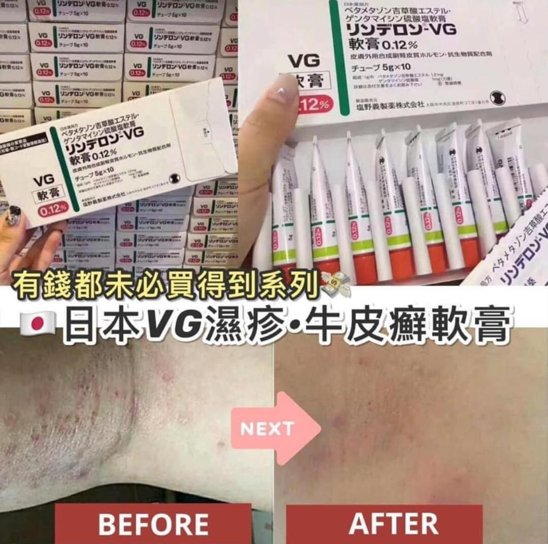 供應商現貨🌸日本🇯🇵VG濕疹軟膏💚 | 預訂 逢星期一，三返倉執貨 其後約3-5個工作天寄出