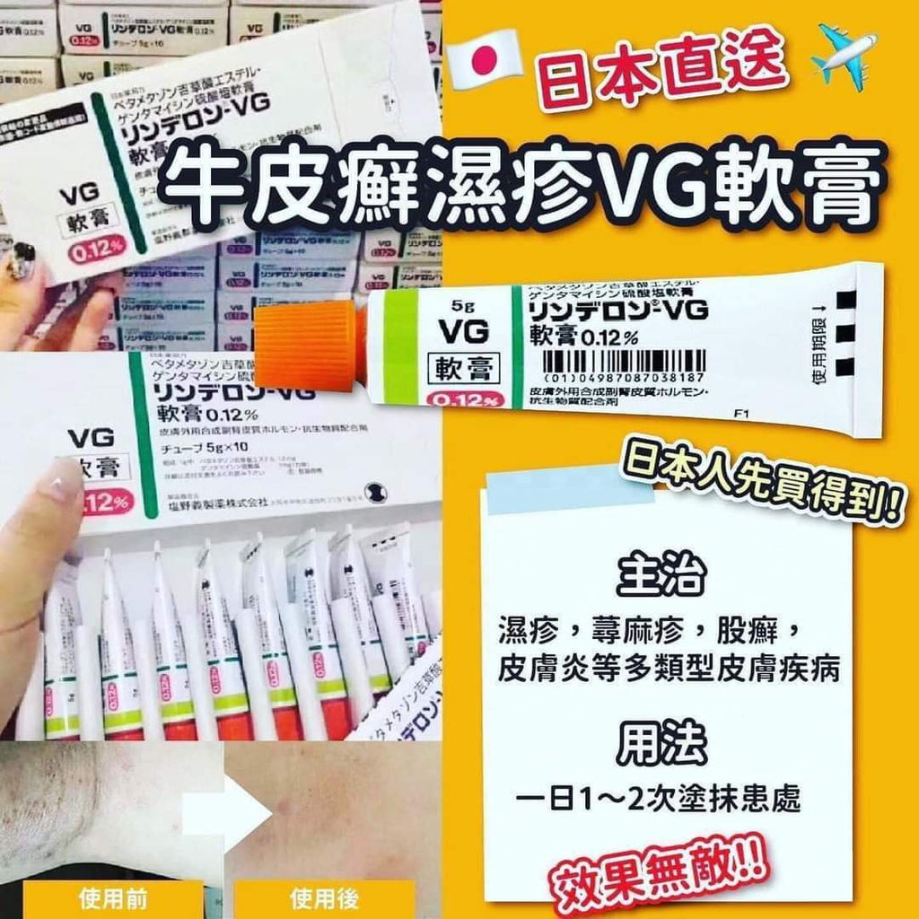 供應商現貨🌸日本🇯🇵VG濕疹軟膏💚 | 預訂 逢星期一，三返倉執貨 其後約3-5個工作天寄出