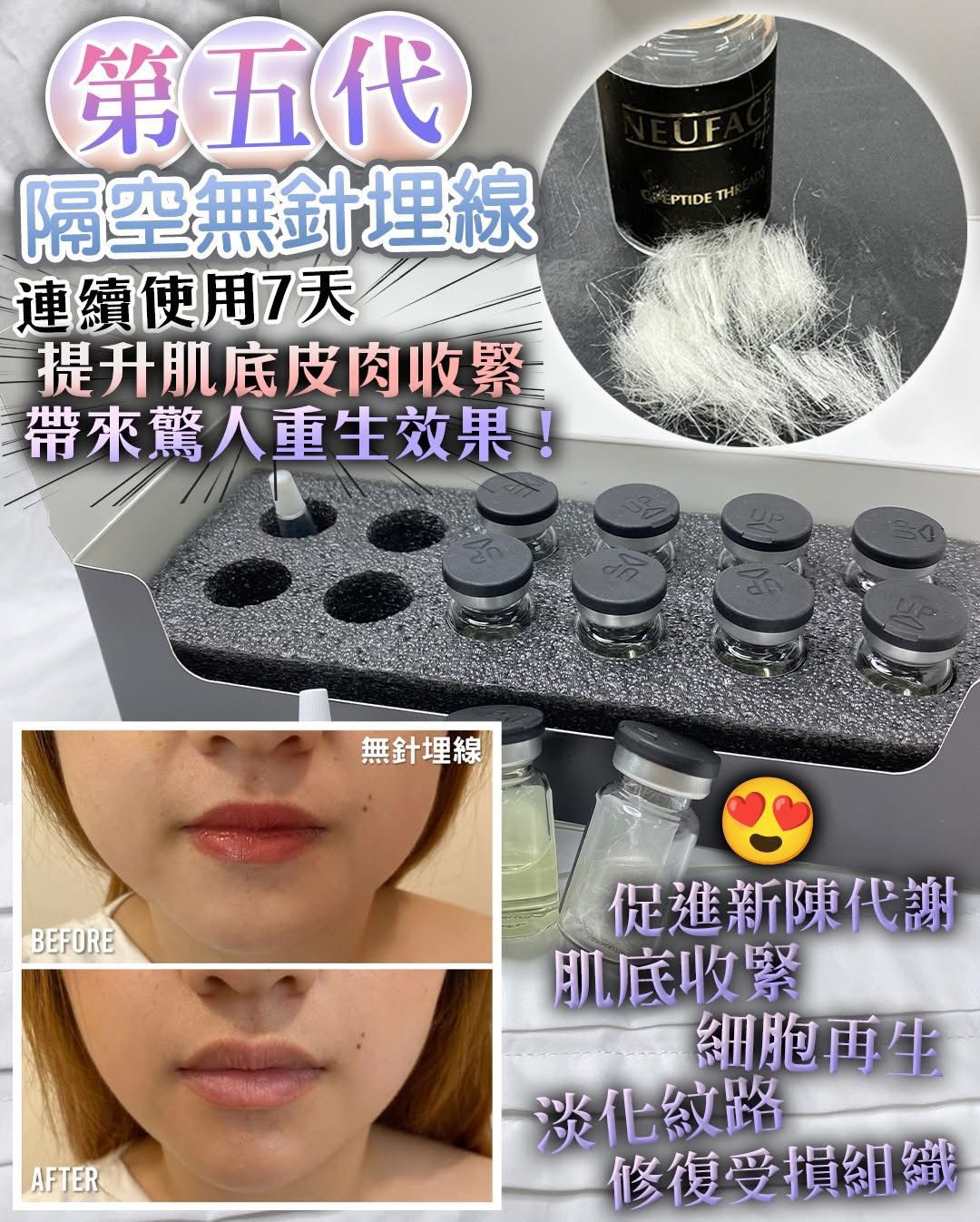 🌸Neuface Pro Demthread隔空無針埋線 | 預訂約1-2星期