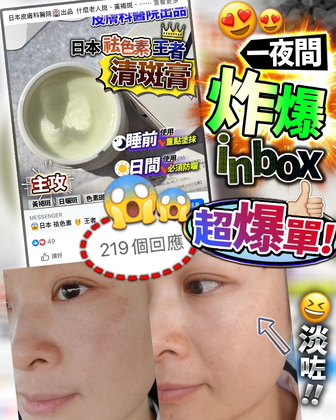 現貨🌸清斑膏 | 落單後約3-5個工作天寄出