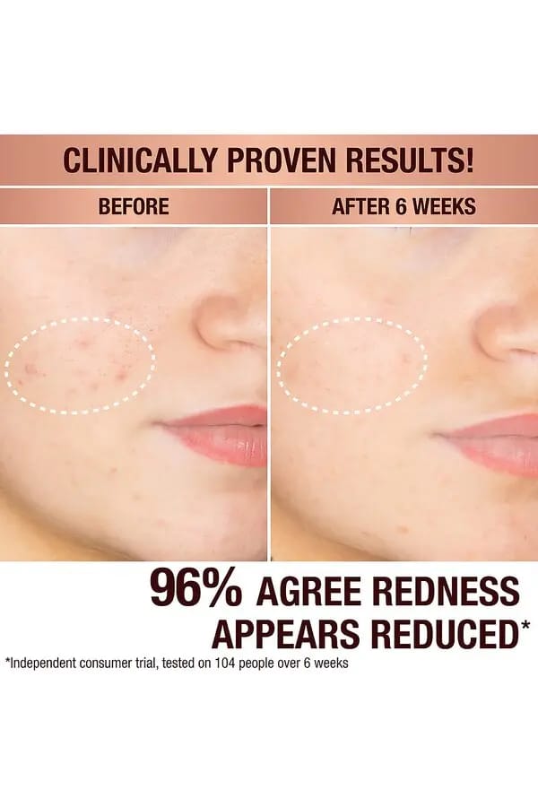 售完即止🌸✨💨快閃預訂💨✨免稅正品 Charlotte Tilbury CT 暗斑透亮精華30ml | 預訂約2-3星期