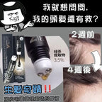現貨🌸韓國🇰🇷MBA 升級版🆙🆙頭皮生髮滾珠黑髮精華 ~20ml | 落單後約5-7個工作天寄出