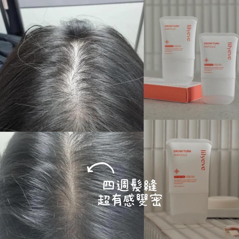 11月8日截🌸韓國🇰🇷最新🔥lilyeve防脫育髮外泌體安瓶精華 100ml | 預訂約12月中至尾