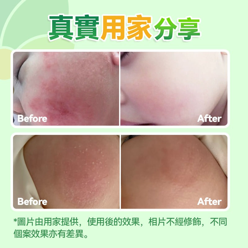 🌸日本Healthive 天然抗敏消紅止癢多用途消炎修護母嬰級皮膚凝膠 120ml | 預訂約2星期