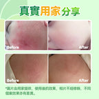 🌸日本Healthive 天然抗敏消紅止癢多用途消炎修護母嬰級皮膚凝膠 120ml | 預訂約2星期