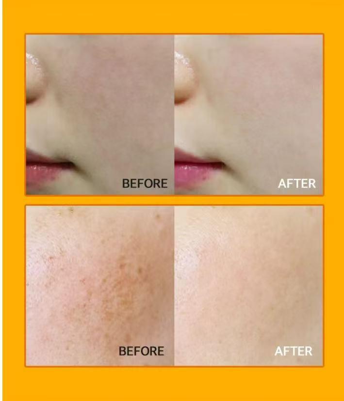 11月30日截🌸韓國🇰🇷新上市🆕VELLA美白頸霜 | 預訂約3-4星期