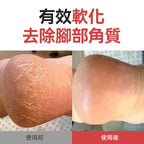 12月11日2300截🌸韓國直送Olive young # OL342 🌸Sungboon Editor 足部護理棒20g | 預訂約12月尾至1月初