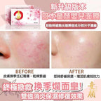 🌸日本人氣 POKIIWA童顏面膜（7片） 2盒送3片童顏+1盒精華油 | 預訂約1月尾至2月初