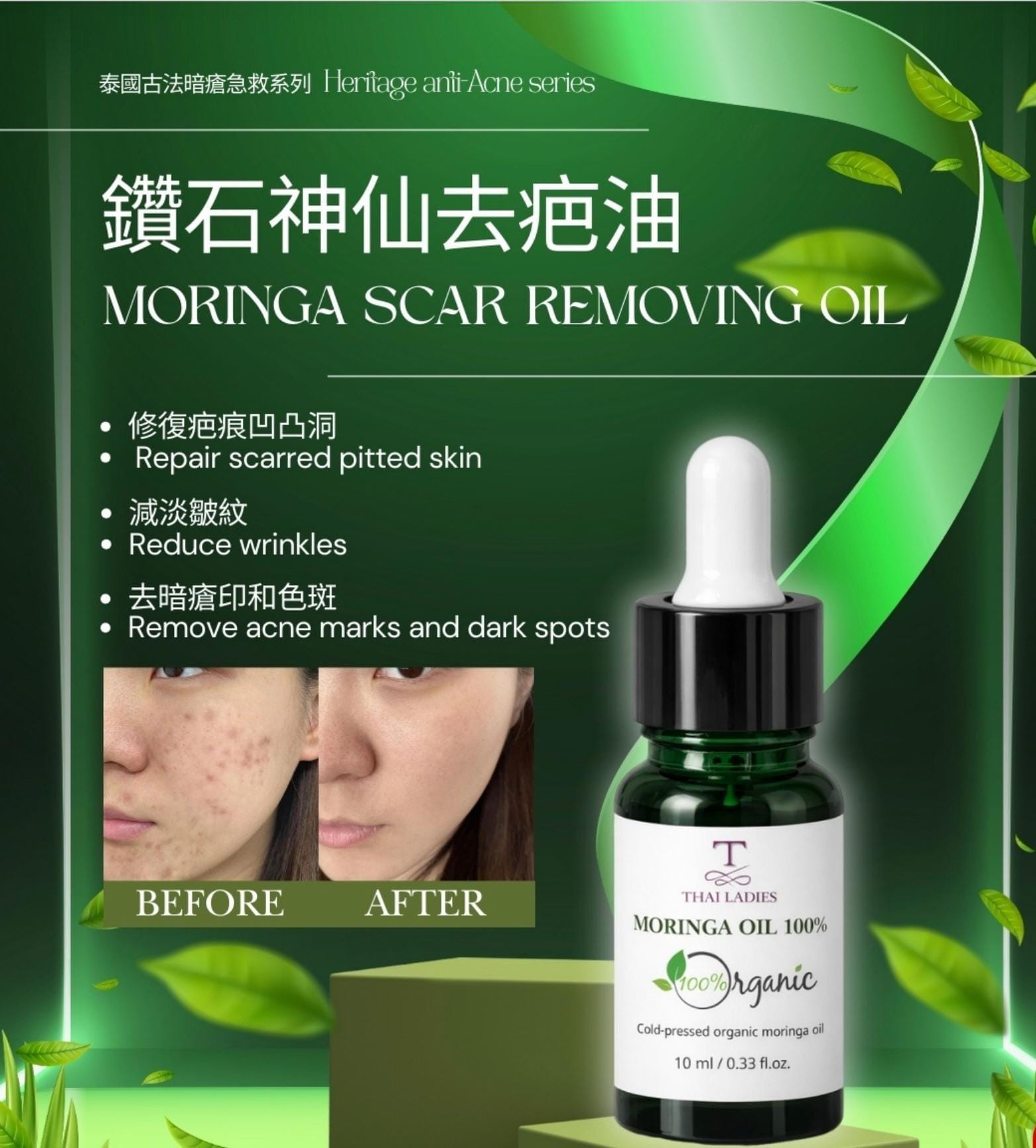 【24小時網站自助下單】2026年2月8日截🌸🌟鑽石神仙去疤油 | 預訂約1-2星期 新年前