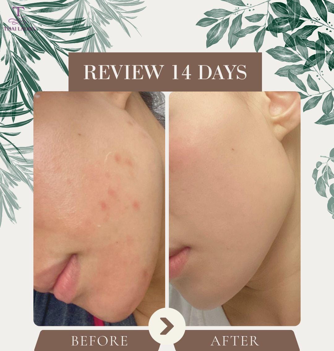 【24小時網站自助下單】2026年2月8日截🌸🌟鑽石神仙去疤油 | 預訂約1-2星期 新年前