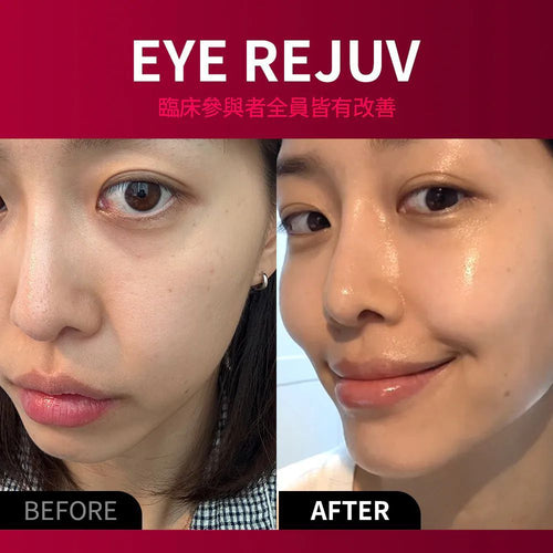 【24小時網站自助下單】現貨🌸 BEAUND Eye Rejuv 眼部煥顏抗皺護理儀 | 落單後約3-5個工作天寄出 娉婷貿易公司 Exquisite Beauty Trading Company