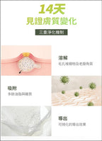 【24小時網站自助下單】現貨🌸EIOM 祛痘淨膚面膜（Trouble Patch Mask）1盒4片 | 落單後約3-5個工作天寄出 娉婷貿易公司 Exquisite Beauty Trading Company