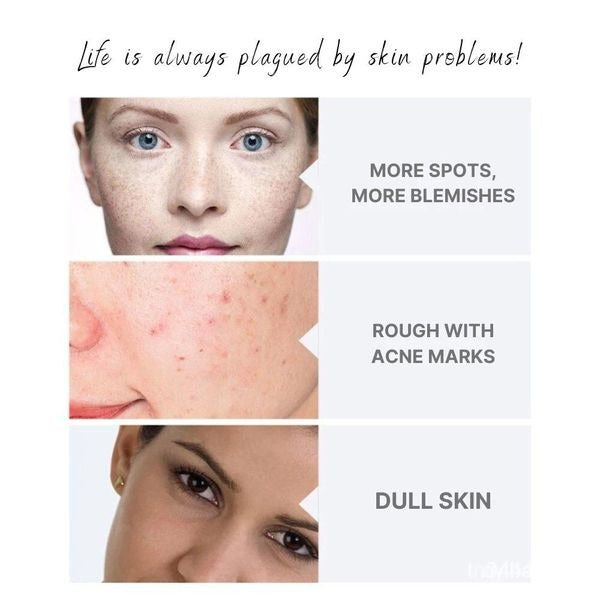 【24小時網站自助下單】🌸韓國 MelaNosa Cream 褪黑素袪斑霜加強版30g | 預訂約4月尾至5月初