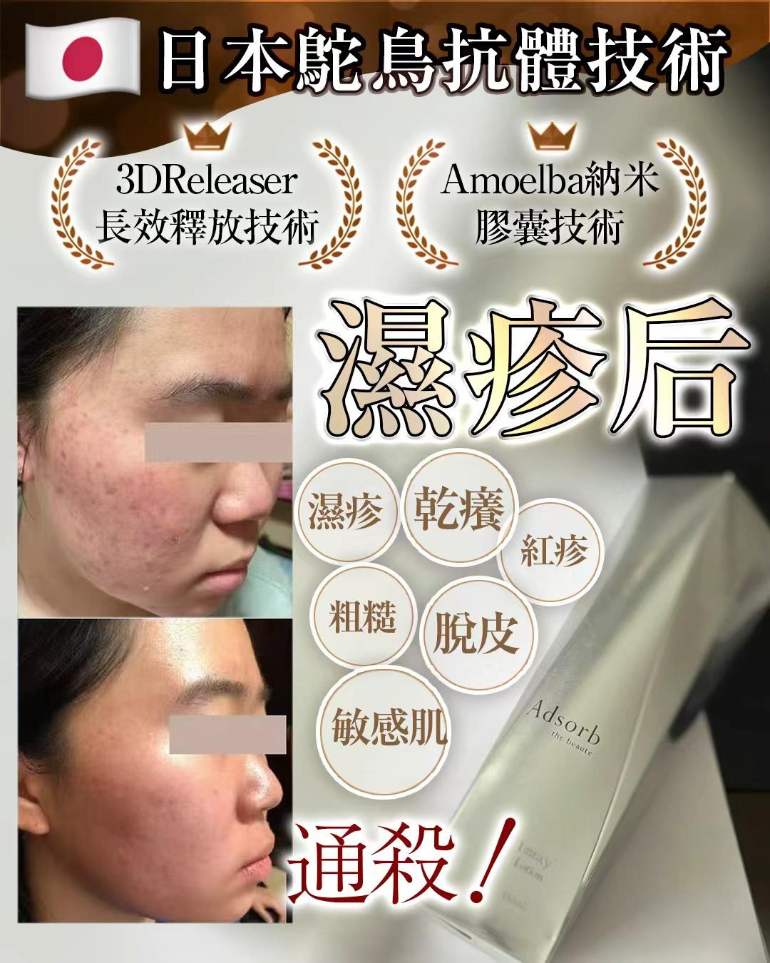 【24小時網站自助下單】🌸濕疹后 180ml | 預訂約2-3星期