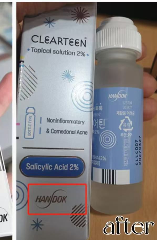 【24小時網站自助下單】 現貨🌸韓國藥房熱賣 HANDOK Acne Clearteen 水楊酸祛痘抗粉刺抗痘水 – 30ml | 落單後約3-5個工作天寄出 娉婷貿易公司 Exquisite Beauty Trading Company
