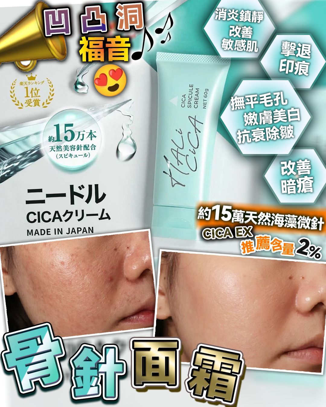 【24小時網站自助下單】🌸凹凸洞 神品 🔥 HALI CICA SPICULE海藻微針面霜 (增量版）60g | 預訂約2-3星期 娉婷貿易公司 Exquisite Beauty Trading Company