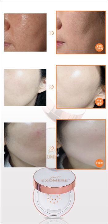 【24小時網站自助下單】🌸韓國TIME72 EXOMERE外泌體微針氣墊 15G | 預訂約2026年4月尾至5月初