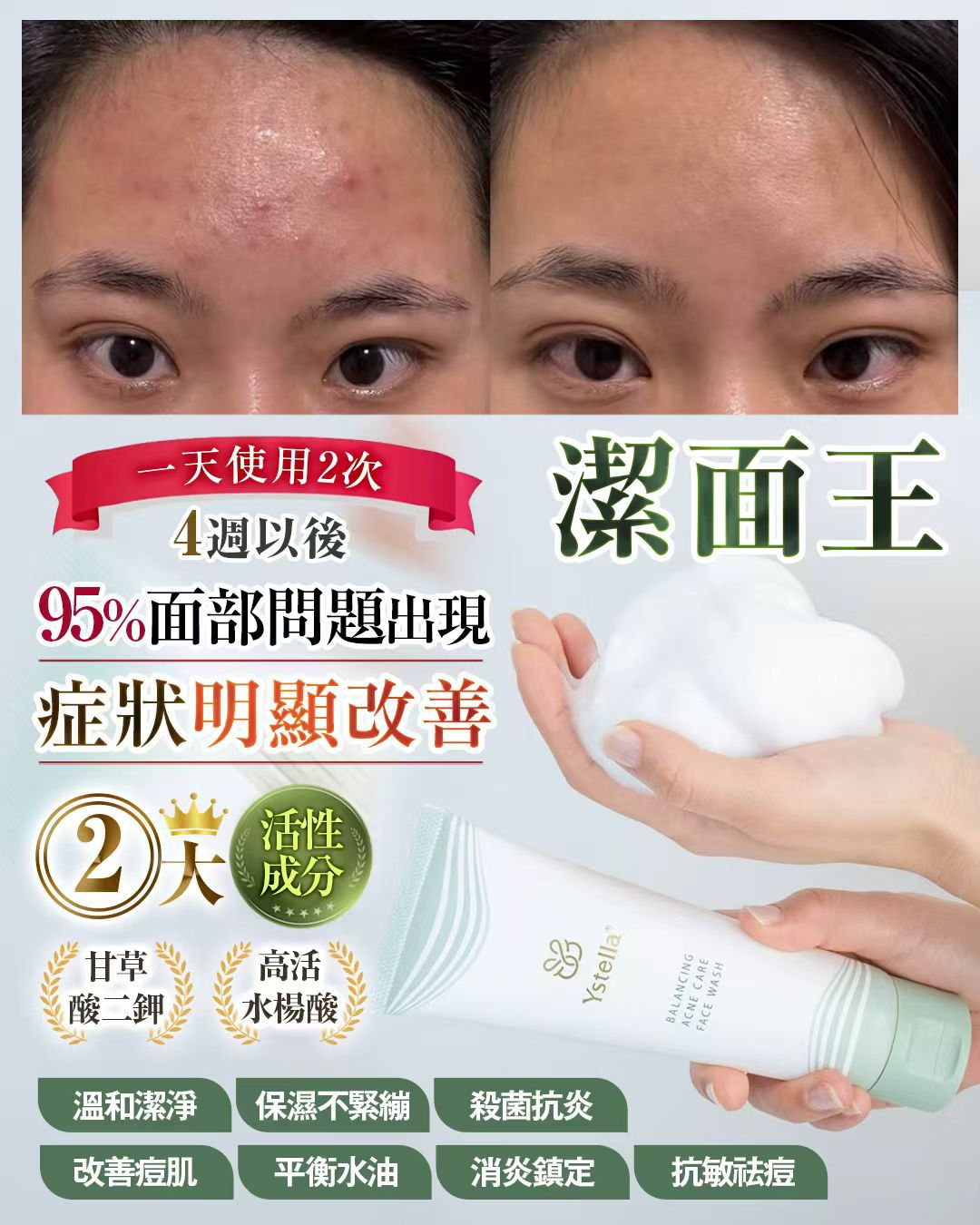 【24小時網站自助下單】少量現貨🌸Ystella潔面王❤️送潔面網 | 落單後約3-5個工作天寄出 娉婷貿易公司 Exquisite Beauty Trading Company
