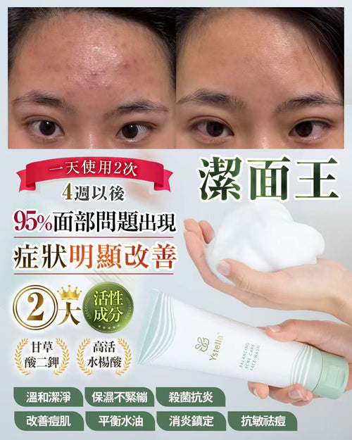 【24小時網站自助下單】少量現貨🌸Ystella潔面王❤️送潔面網 | 落單後約3-5個工作天寄出 娉婷貿易公司 Exquisite Beauty Trading Company