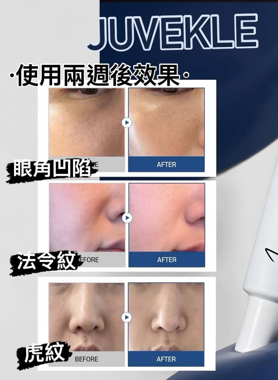 【24小時網站自助下單】🌸全新 🆕RX:ME 品牌推出的 Juvekle Ultra PDLLA 10,000+ 亮肌修復童顏緊緻乳霜 (30ml) 🌟🌟🌟🌟🌟 | 預訂約4-5星期