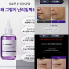 【24小時網站自助下單】🌸🆕韓國最新出🇰🇷Melable 提升彈性緊緻安瓶潔面乳150ml U-therable BoostUp Ampoule Cleanser | 預訂約2-3星期