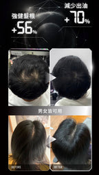 【24小時網站自助下單】售完即止🌸香港行貨 台灣Relove 髮量爆澎套裝：黑泌肽豐盈洗髮精+養髮液 | 預訂約2-3星期