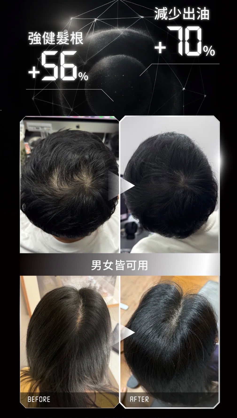 【24小時網站自助下單】售完即止🌸香港行貨 台灣Relove 髮量爆澎套裝：黑泌肽豐盈洗髮精+養髮液 | 預訂約2-3星期