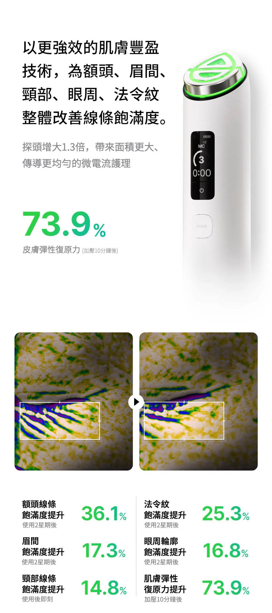 【24小時網站自助下單】現貨🌸Medicube [9in1多功能升級] AGE-R Booster Pro X2 | 落單後約3-5個工作天寄出