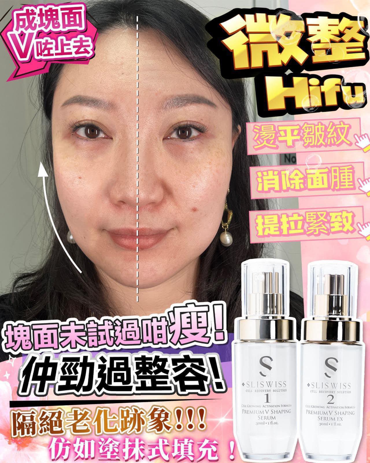即納🌸スイスSliswiss Plus 整形レベル1+2セット（フィラーリフトアップ美容液＋糸リフトVフェイス美容液） | ご注文後3-5営業日程度で発送