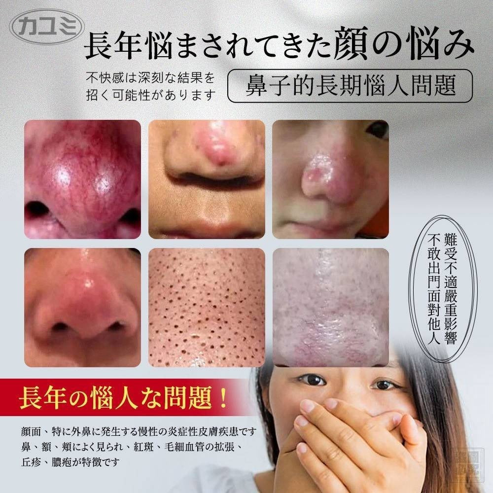 【24小時網站自助下單】2026年7月4日截🌸🟡日本カユミ-酒槽鼻專用修復毛孔膏20g🟡 | 預訂約8月尾至9月初
